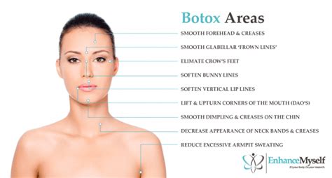 Botox Injections Got Wrinkles Cost Risks Recovery Etc