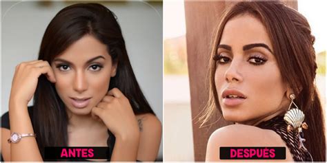 La actriz confesó que ya se hizo 8 ecografías porque necesita saber qué está haciendo. Cirugías de Anitta (+Antes y después) - Cirugias.de