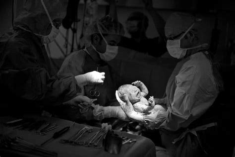 Opinion Not Every C Section Is A Bad Birth Story The New York Times