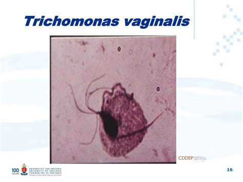 Pdf Trichomonas Vaginalis Center For Disease Dynamics
