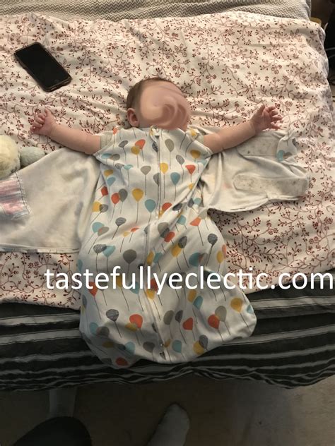 Unilateral clubfoot foot size/leg length discrepancy? clubfoot-baby-10 - Tastefully Eclectic