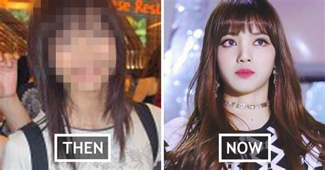 If you have already had lisa blackpink before plastic surgery and want if for any reason you cant use plastic surgery, then you are natural techniques. Fans Share Proof That BLACKPINK Lisa Never Did Plastic Surgery
