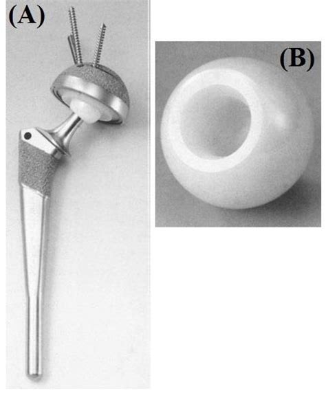 A Hip Prosthesis By Titanium Alloy With Zirconia Ball Head And B