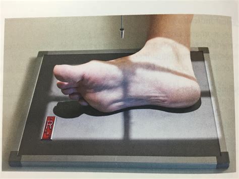 Positioning For Foot Lateral Xray Study Guide