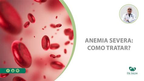 Anemia Severa Como Tratar Dr Salim Crm 43163 Youtube