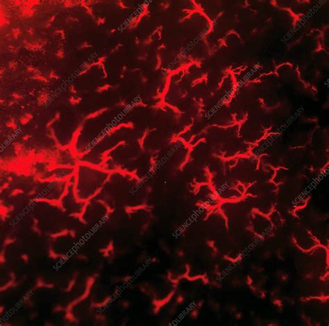A blood vessel that is part of a kidney automatically generated definition. Kidney blood vessels - Stock Image - C049/0396 - Science ...
