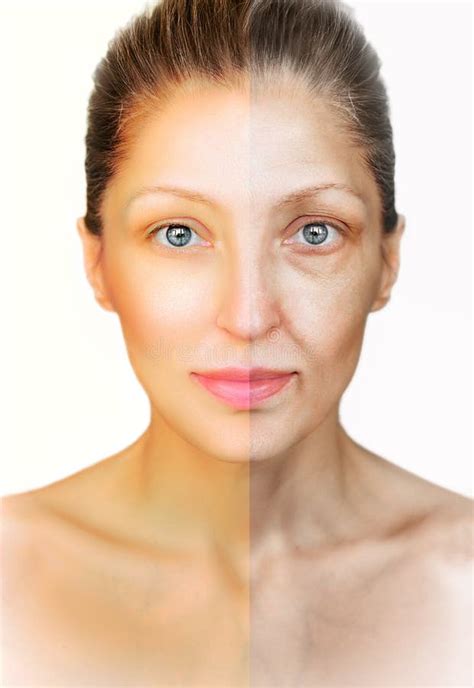 Anti Aging Procedure Before And After Stock Photo Image Of Human