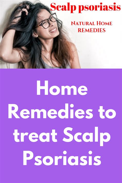 Home Remedies To Treat Scalp Psoriasis This Article Points Out The