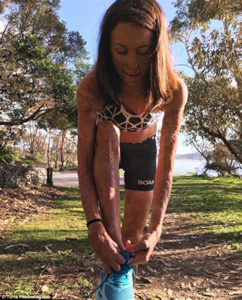 Turia Pitt Discusses Competing In The Intense Ironman World Championships In Hawaii Daily Mail