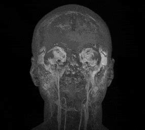 Mri GIF Find Share On GIPHY