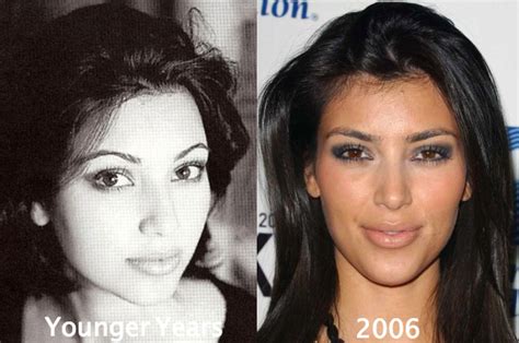 Kim Kardashian Plastic Surgery Before After See Yourself How Plastic