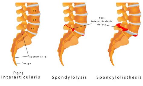 Our sleeping ninjas have created a list of the best mattresses for lower back pain, so you can pick and choose which ones work best for you. Best Mattresses for Back Pain Reviews 2018 | The Sleep Judge