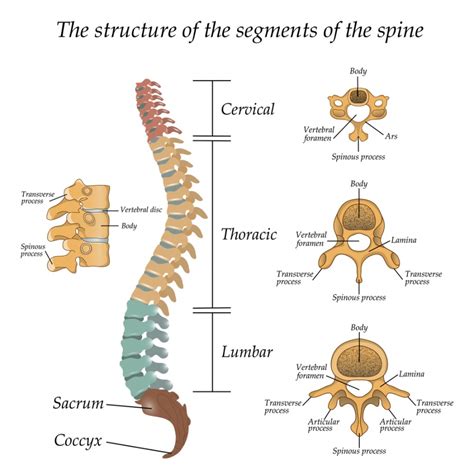 Pictures of broken bones and stress fractures. Anatomy of Spinal Stenosis