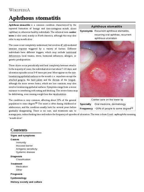 Aphthous Stomatitis Pdf Immunology Diseases And Disorders