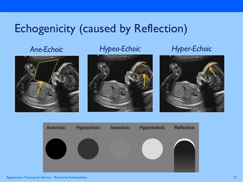 Basics Physics Of Ultrasound