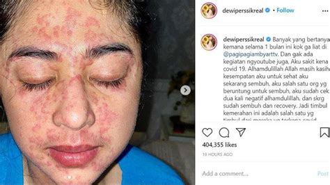 Bintik Bintik Merah Pada Kulit Gejala Penyakit Apa Biasanya