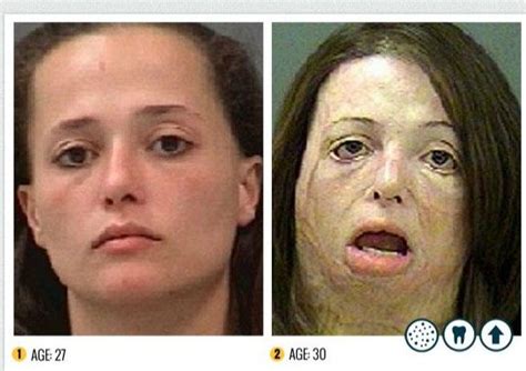 today s gist the horror of meth before and after pictures reveal shocking transformation in