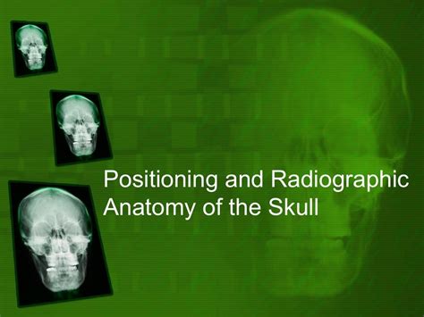 Positioning And Radiographic Anatomy Of The Skull