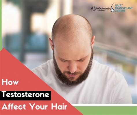 how testosterone affect your hair and make you bald