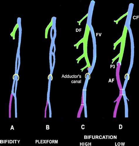 Anatomical Variations Of The Femoral Vein Journal Of Vascular Surgery
