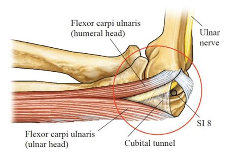 Ulnar Nerve Entrapment At The Elbow Acusport Education