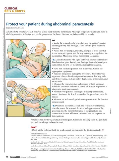 Protect Your Patient During Abdominal Paracentesis Nursing2022