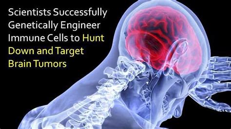 Immune Cells Hunt Down Deadly Brain Tumors Thanks To Novel Target