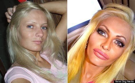 Model Spends Thousands On Plastic Surgery To Look Like A Sex Doll Says She S Happy And
