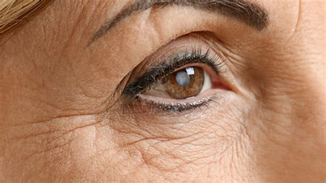 Comprendre La Cataracte Causes Symptômes Et Traitements