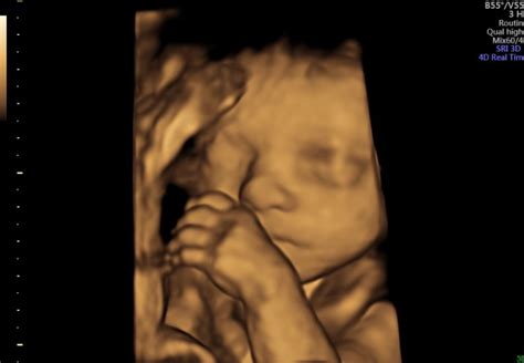 Elite Ultrasound Elite Ultrasound 4d Baby Scan Paisley East