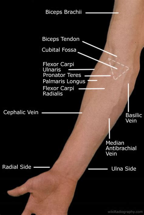 Elbow Forearm Wikiradiography