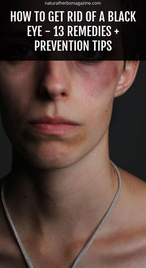 Dec 23, 2012 · to get rid of chlorine, you should take a pair of goggles and then face down. How To Get Rid Of A Black Eye - 13 Remedies + Prevention ...