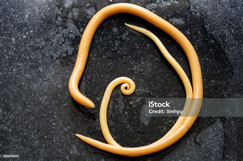 Ascariasis Is A Disease Caused By The Parasitic Roundworm Ascaris