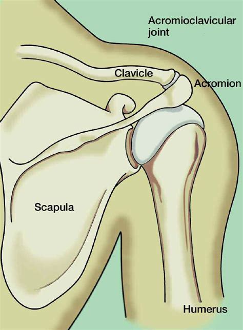 Acromioclavicular Ac Joint Separation Repair The Institute For