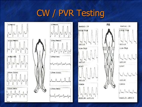 Ppt Vascular Surgery 101 Vascular Assessment And Pad Powerpoint
