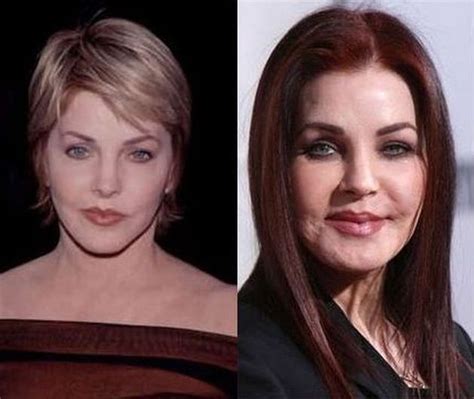 Priscilla Presley Before And After Plastic Surgery | Bad ...