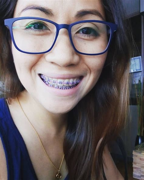 Braces Braceface Metalbraces Girlswithbraces Glasses