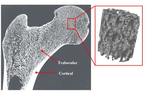 Cross Section Of Human Femur Showing Trabecular And Cortical Bone From