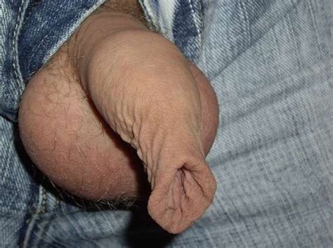 Foreskinfetish16 Porn Pic From Long Labia And Saggy