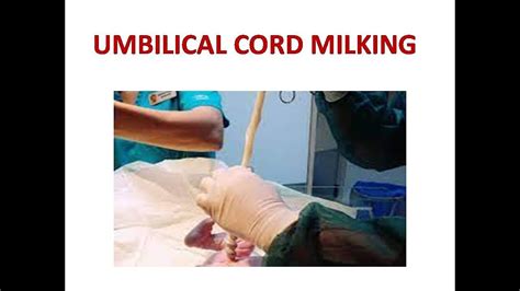 Umbilical Cord Milking Youtube