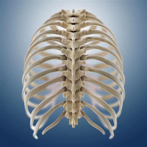 Ribcage Photograph By Springer Medizin Science Photo Library