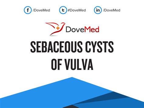 Vestibular Vulvar Cysts