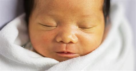 Jaundice Explained Cause And Solutions To Reduce Jaundice In Babies