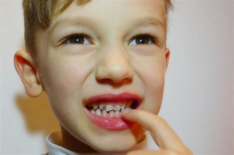 5 Shocking Facts About Kids Oral Health In Australia Kelmscott Dental