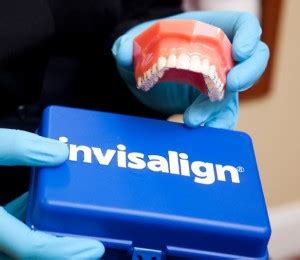Multiple factors can influence your final bill. Invisalign®: The Clear Choice