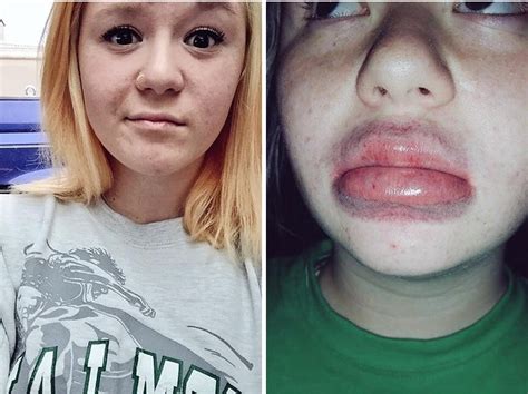 Horrifying Results Of The Kylie Jenner Challenge