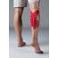 Bloem Physio  Gastrocnemius/soleus Strain Lower Leg Injuries
