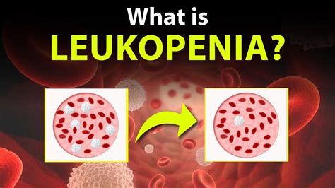 Lets Know About The Leukopenia Youtube