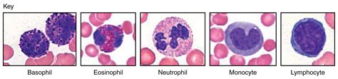 Macrophage Vs Lymphocyte Histology