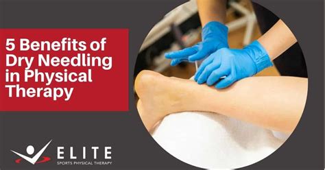 5 benefits of dry needling in physical therapy elite sports